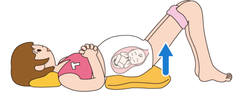 妊婦　骨盤ベルト基本姿勢